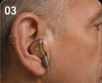 Hearing loss patient education visual