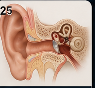 Otosclerosis and conductive hearing loss patient education visual
