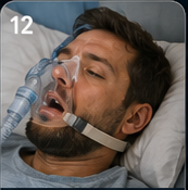 Snoring and sleep apnea patient education visual