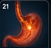 Throat reflux and LPR symptoms patient education visual